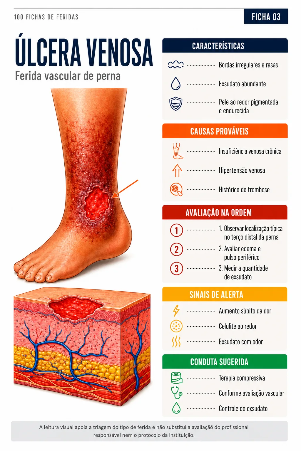 Ficha 03 — Úlcera venosa