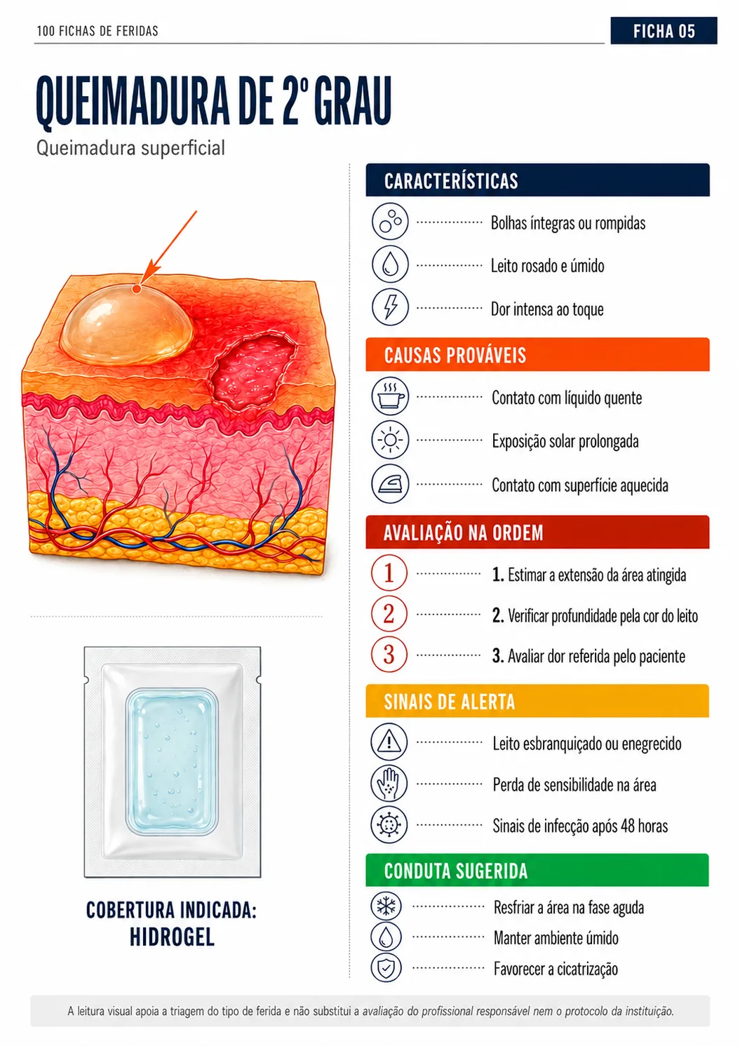 Ficha 05 — Queimadura 2º grau